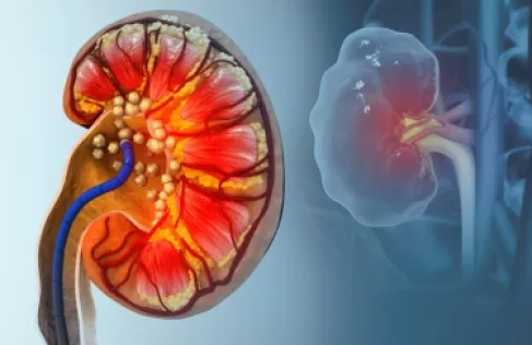 خطرها يتراكم مع الوقت.. أطعمة قد تضع الكلى تحت الضغط