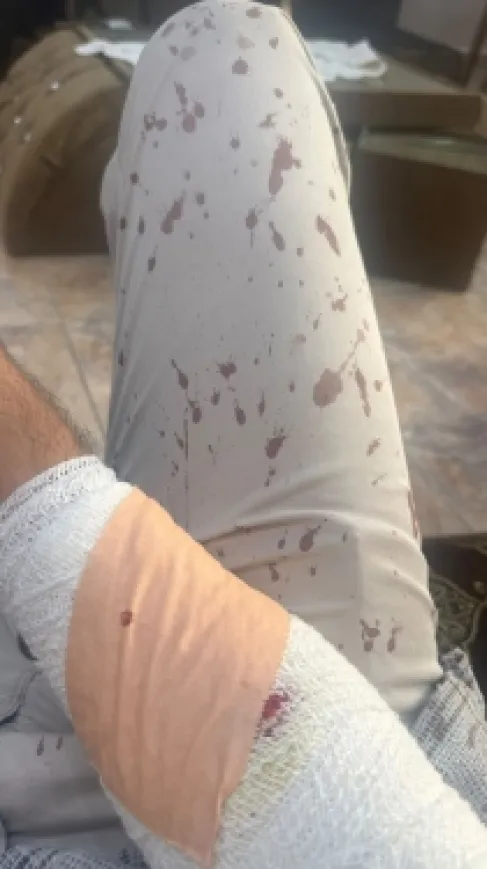 طالب يعتدي على معلم بمنشار في الزرقاء