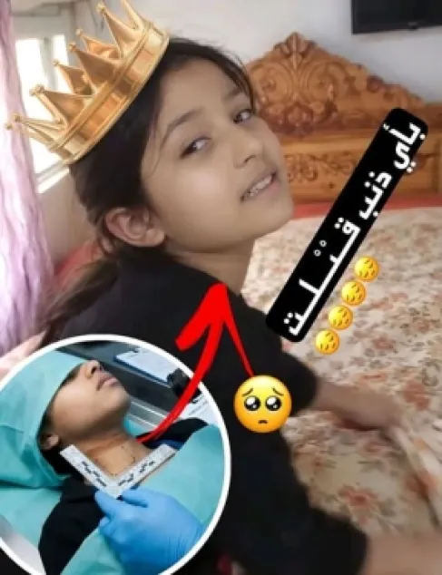 شكوك حول زوجة الأب.. وفاة غامضة لطفلة تثير تفاعلا واسعا في اليمن