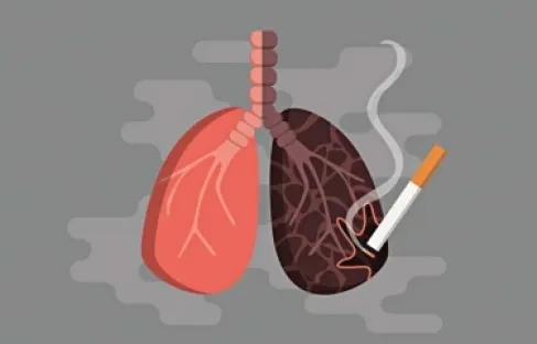 أخطر مما يُعتقد.. التدخين يهيّئ خلايا الرئة للتحول إلى سرطان