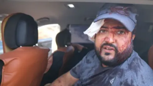 إصابة فلسطينيين وصحافية أمريكية في هجوم لمستوطنين إسرائيليين خلال قطف الزيتون بالضفة