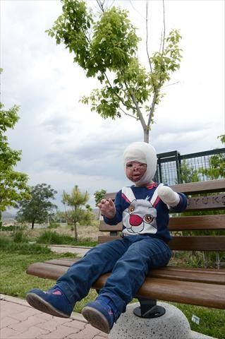 نار الحرب شوهت وجه جنى - صور