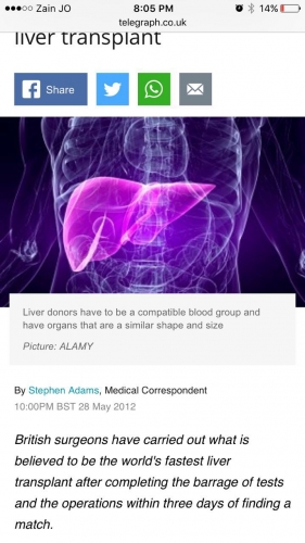 أسرع زراعة كبد في الأردن - صور