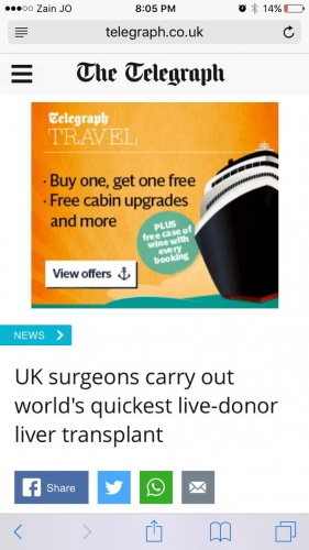 أسرع زراعة كبد في الأردن - صور